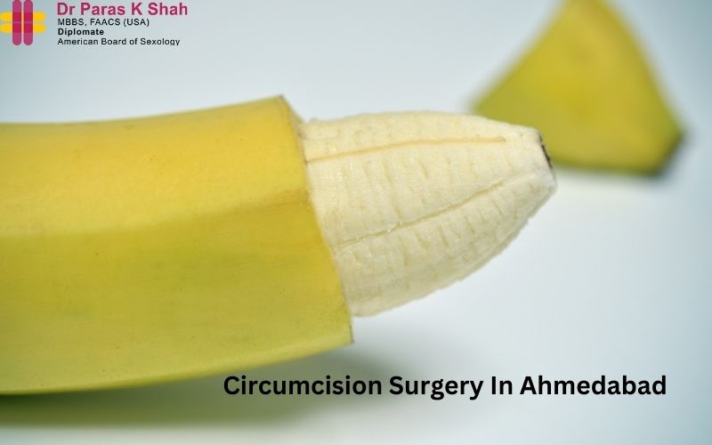 Circumcision Surgery In Ahmedabad | Dr. Paras Shah